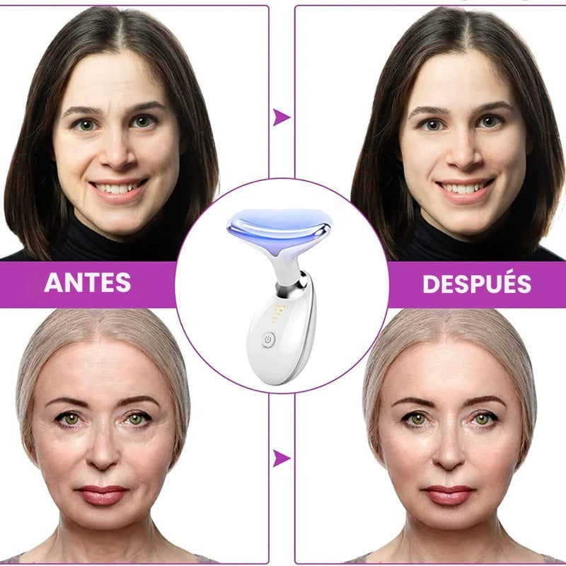 FacialChic® - Masajeador Facial Antipapada + Ebook Gratuito Rejuvenece En 30 Días