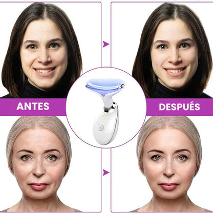 FacialChic® - Masajeador Facial Antipapada + Ebook Gratuito Rejuvenece En 30 Días