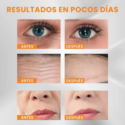 BellaVita® Kit de Colágeno Profesional - Revitaliza tu Piel en 7 días